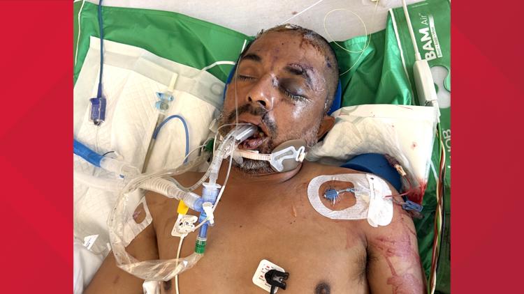 University Hospital asks for help identifying unconscious patient hit by truck Saturday evening — KENS 5 (San Antonio), Orinda Health news