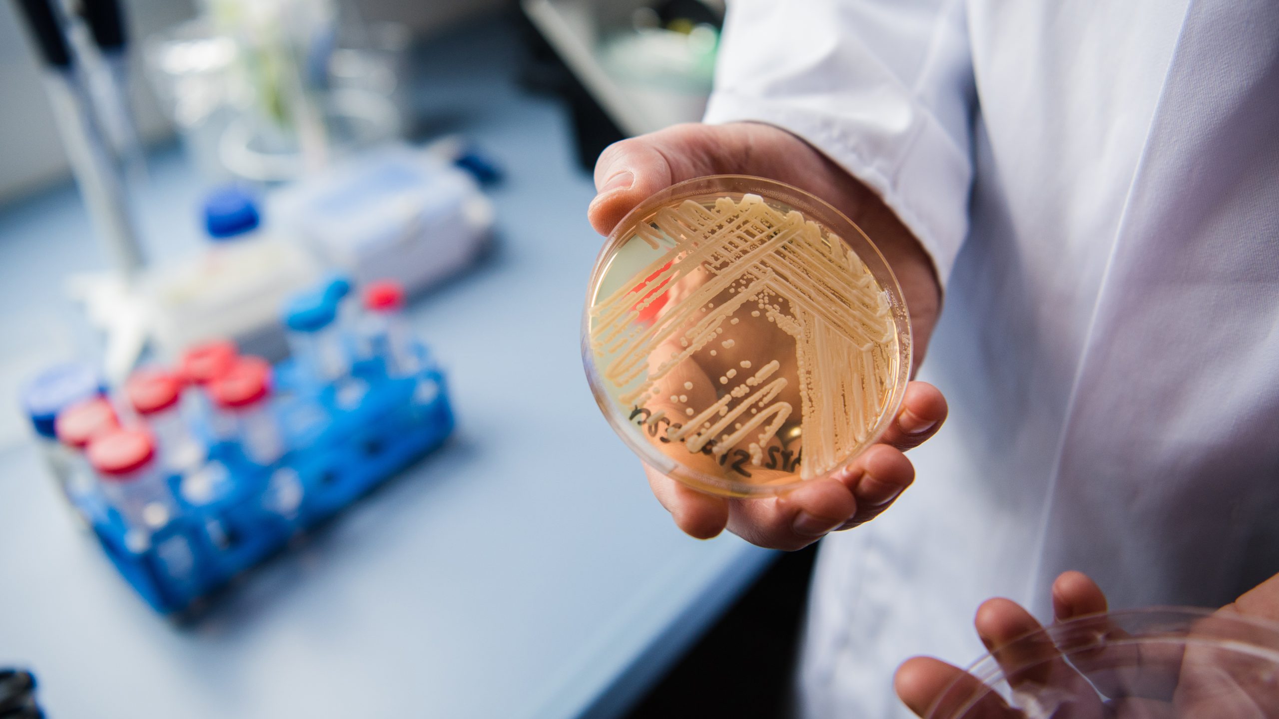 New study reveals why dangerous fungus is so difficult to treat — KTVU FOX 2 Bay Area, Orinda Community news